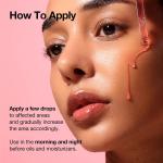 سرم ضد لک و روشن‌کننده نیاسینامید ۱۰٪ و ترانگزامیک اسید ۴٪ آنوا