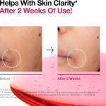 سرم ضد لک و روشن‌کننده نیاسینامید ۱۰٪ و ترانگزامیک اسید ۴٪ آنوا